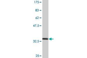 Western Blot detection against Immunogen (35. (MATK antibody  (AA 422-507))