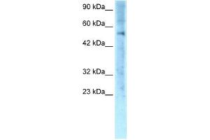 Human Jurkat; WB Suggested Anti-ZNF500 Antibody Titration: 0. (ZNF500 antibody  (Middle Region))