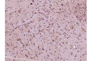 Paraformaldehyde-fixed, paraffin embedded mouse brain, Antigen retrieval by boiling in sodium citrate buffer (pH6) for 15min, Block endogenous peroxidase by 3% hydrogen peroxide for 30 minutes, Blocking buffer (normal goat serum) at 37°C for 20min, Antibody incubation with Apolipoprotein E Polyclonal Antibody, Unconjugated  at 1:400 overnight at 4°C, followed by a conjugated secondary and DAB staining. (APOE antibody  (AA 151-250))