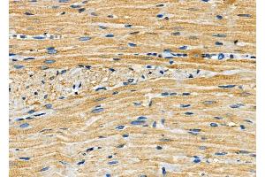 ABIN6260056 and ABIN6272251 at 1/100 staining Rat heart tissue by IHC-P. (ARRDC4 antibody  (Internal Region))
