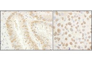 anti-General Transcription Factor IIE, Polypeptide 1, alpha 56kDa (GTF2E1) (AA 389-439) antibody