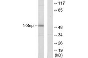 Western blot analysis of extracts from Jurkat cells, using SEPT1 Antibody.