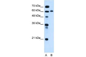 anti-Inositol 1,4,5-Triphosphate Receptor Interacting Protein-Like 1 (ITPRIPL1) (C-Term) antibody