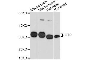 Western blot analysis of extracts of various cell lines, using OTP antibody (ABIN6293433) at 1:3000 dilution.