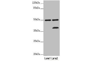 Western blot All lanes: PLIN5 antibody at 2 μg/mL Lane 1: Mouse kidney tissue Lane 2: Mouse brain tissue Secondary Goat polyclonal to rabbit IgG at 1/10000 dilution Predicted band size: 51 kDa Observed band size: 51, 36 kDa (PLIN5 antibody  (AA 305-453))