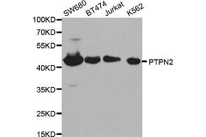 Western blot analysis of extracts of various cell lines, using PTPN2 antibody (ABIN5970915) at 1/1000 dilution. (PTPN2 antibody)
