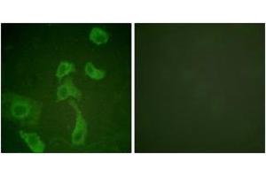 Immunofluorescence analysis of HeLa cells, using IL-2R beta (Ab-364) Antibody. (IL2 Receptor beta antibody  (AA 331-380))