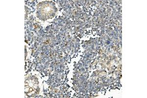 IHC analysis of Bid using anti-Bid antibody (ABIN7599062). (BID antibody  (AA 1-195))
