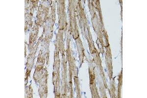 Immunohistochemistry of paraffin-embedded mouse heart using PDGFRA Rabbit pAb (ABIN3022920, ABIN3022921, ABIN3022922 and ABIN6219298) at dilution of 1:50 (40x lens). (PDGFRA antibody  (AA 1-210))