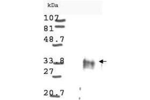 Western blot analysis is shown using  anti-Cyclin D1 antibody to detect Human Cyclin D1 present in asynchronous HN30 cell lysates. (Cyclin antibody)