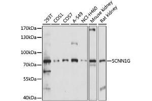 Western blot analysis of extracts of various cell lines, using SCNN1G antibody. (SCNN1G antibody)