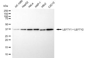 anti-Left-Right Determination Factor 2 (LEFTY2) antibody