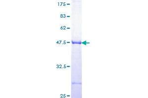 Image no. 1 for Leucine Rich Repeat (In FLII) Interacting Protein 1 (LRRFIP1) (AA 675-784) protein (GST tag) (ABIN1309804) (LRRFIP1 Protein (AA 675-784) (GST tag))