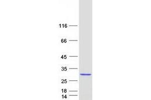 Validation with Western Blot