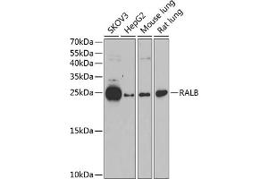 Western blot analysis of extracts of various cell lines, using RALB antibody (ABIN1682468, ABIN5664619, ABIN5664621 and ABIN6220484) at 1:1000 dilution. (RALB antibody  (AA 1-206))
