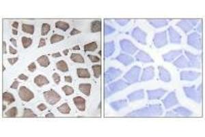 Immunohistochemistry analysis of paraffin-embedded human skeletal muscle tissue using MRPS18C antibody. (MRPS18C antibody)