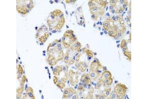 Immunohistochemistry of paraffin-embedded Human stomach using GLS Polyclonal Antibody at dilution of 1:100 (40x lens). (Glutaminase antibody)