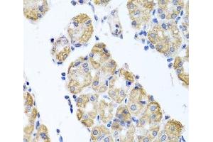 Immunohistochemistry of paraffin-embedded Human stomach using GLS Polyclonal Antibody at dilution of 1:100 (40x lens). (Glutaminase antibody)