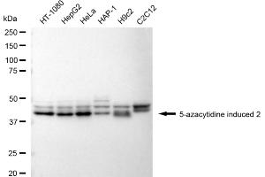 anti-5-Azacytidine Induced 2 (AZI2) antibody