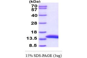 SDS-PAGE (SDS) image for Cystatin A (Stefin A) (CSTA) (AA 1-98) protein (His tag) (ABIN667399) (CSTA Protein (AA 1-98) (His tag))