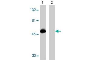 Western blot analysis using CX3CR1 polyclonal antibody  at 1 ug/mL on THP-1 cell lysate in the absence (lane 1) and presence (lane 2) of specific blocking peptide. (CX3CR1 antibody  (AA 175-189))