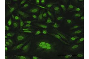 Immunofluorescence of purified MaxPab antibody to CDKN2D on HeLa cell. (CDKN2D antibody  (AA 1-166))