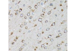 Immunohistochemistry of paraffin-embedded Rat brain using UBE2D1 Polyclonal Antibody at dilution of 1:100 (40x lens). (UBE2D1 antibody)