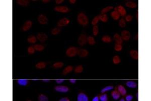 Immunofluorescence analysis of HeLa cells using JNK1 Polyclonal Antibody at dilution of 1:100 (40x lens). (JNK antibody)