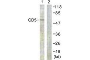 Western Blotting (WB) image for anti-CD5 (CD5) (AA 421-470) antibody (ABIN2888797) (CD5 antibody  (AA 421-470))