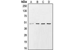 Western blot analysis of CK1 gamma 2 expression in HeLa (A), Raw264.