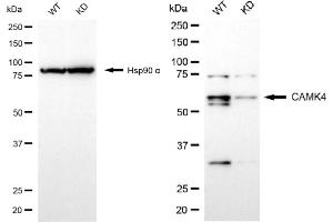 Western blotting analysis using CAMK4 antibody (ABIN7797838). (Recombinant CAMK4 antibody)