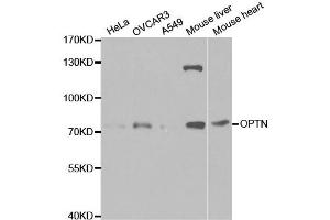 Western Blotting (WB) image for anti-Optineurin (OPTN) antibody (ABIN1874007) (OPTN antibody)