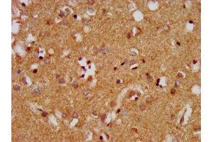 IHC image of ABIN7159750 diluted at 1:400 and staining in paraffin-embedded human brain tissue performed on a Leica BondTM system. (MAP1A antibody  (AA 1979-2168))