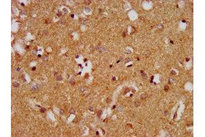 IHC image of ABIN7159750 diluted at 1:400 and staining in paraffin-embedded human brain tissue performed on a Leica BondTM system.