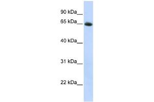 WB Suggested Anti-SLC2A4 Antibody Titration:  0.