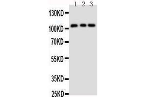 Anti-TRPC6 antibody, Western blotting Lane 1: Rat Lung Tissue Lysate Lane 2: 293T Cell Lysate Lane 3: 293T Cell Lysate (TRPC6 antibody  (Middle Region))