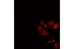 ABIN6276291 staining 293 cells by IF/ICC. (BAK1 antibody  (N-Term))