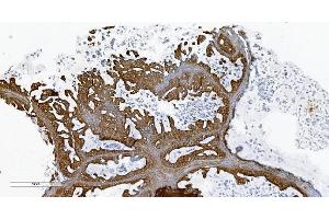 IHC analysis of PLTP using anti-PLTP antibody (ABIN7600346). (PLTP antibody  (AA 18-470))