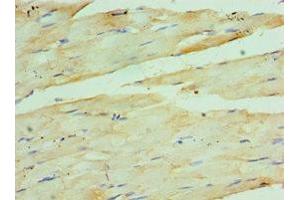 Immunohistochemistry of paraffin-embedded human skeletal muscle tissue using ABIN7142608 at dilution of 1:100 (Coq7 antibody  (AA 37-217))