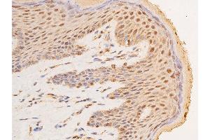 Immunohistochemistry (IHC) image for anti-Tumor Protein P53 (TP53) (pSer15) antibody (ABIN6256151)
