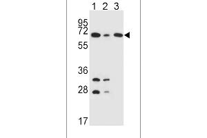 DLAT Antibody (C-term) (ABIN651534 and ABIN2840283) western blot analysis in K562(lane 1),HepG2(lane 2),Jurkat(lane 3) cell line lysates (35 μg/lane). (DLAT antibody  (C-Term))