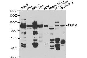 Western blot analysis of extracts of various cell lines, using TRIP10 antibody. (TRIP10 antibody)