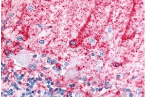 Anti-SLC1A3 / GLAST antibody  ABIN1049331 IHC staining of human brain, cerebellum, molecular layer and Purkinje layer. (SLC1A3 antibody  (Cytoplasmic Domain))