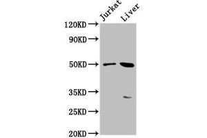 Western Blot Positive WB detected in: Jurkat whole cell lysate, Mouse liver tissue All lanes: BPIFB3 antibody at 3. (BPIFB3 antibody  (AA 248-352))