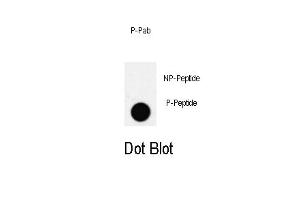 Dot blot analysis of PDX1 Antibody (T11) Pab (ABIN650810 and ABIN2839791) on nitrocellulose membrane. (PDX1 antibody  (pThr11))