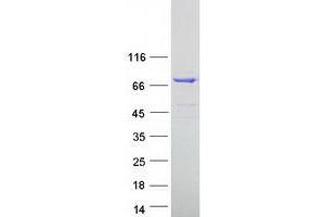 Validation with Western Blot (ESRP1 Protein (Transcript Variant 1) (Myc-DYKDDDDK Tag))