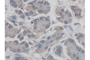 Immunohistochemistry (IHC) image for anti-CD209 (CD209) (AA 70-404) antibody (ABIN7444307)
