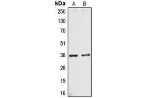 Western blot analysis of CYSLTR1 expression in A10 (A), HT29 (B) whole cell lysates. (CysLTR1 antibody  (Center))