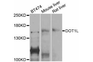 Western blot analysis of extracts of various cell lines, using DOT1L antibody (ABIN5997612) at 1/1000 dilution. (DOT1L antibody)