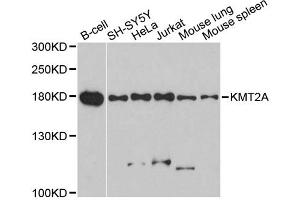 Western blot analysis of extracts of various cell lines, using KMT2A antibody. (MLL/KMT2A antibody)